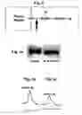 Fig. 10 - Partially deglycosylated glucocerebrosidase polypeptide and crystals thereof