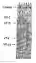 Fig. 01 - Methods for detecting parvovirus infections
