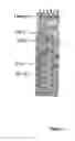 Fig. 03 - Methods for detecting parvovirus infections