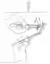 Fig. 44 - APPARATUS AND METHOD FOR HARVESTING AND HANDLING TISSUE SAMPLES FOR BIOPSY ANALYSIS