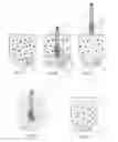 Fig. 03 - MULTIPLEX ASSAYS USING MAGNETIC AND NON-MAGNETIC PARTICLES