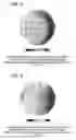 Fig. 04 - Plasma doping method