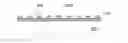 Fig. 01 - Bottom electrode of metal-insulator-metal capacitor