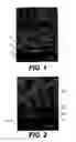 Fig. 02 - Prevention and control of intermetallic alloy inclusions that form during reflow of Pb free, Sn rich, solders in contacts in microelectronic packaging in integrated circuit contact structures where electroless Ni(P) metallization is present