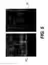 Fig. 04 - Prevention and control of intermetallic alloy inclusions that form during reflow of Pb free, Sn rich, solders in contacts in microelectronic packaging in integrated circuit contact structures where electroless Ni(P) metallization is present