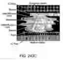 Fig. 121 - Triaxial through-chip connection