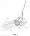 Fig. 04 - GOLF PUTTER WITH LASER