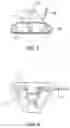 Fig. 06 - GOLF PUTTER WITH LASER