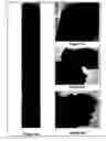 Fig. 04 - Method of consolidating an underground formation
