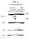 Fig. 07 - Estrogen cancer therapy