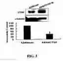 Fig. 04 - METHODS AND COMPOSITIONS FOR DIAGNOSING AND SUPPRESSING METASTASIS THEREOF