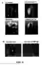 Fig. 07 - METHODS AND COMPOSITIONS FOR DIAGNOSING AND SUPPRESSING METASTASIS THEREOF