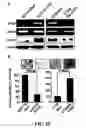 Fig. 11 - METHODS AND COMPOSITIONS FOR DIAGNOSING AND SUPPRESSING METASTASIS THEREOF