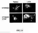 Fig. 12 - METHODS AND COMPOSITIONS FOR DIAGNOSING AND SUPPRESSING METASTASIS THEREOF