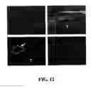 Fig. 13 - METHODS AND COMPOSITIONS FOR DIAGNOSING AND SUPPRESSING METASTASIS THEREOF