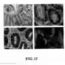 Fig. 14 - METHODS AND COMPOSITIONS FOR DIAGNOSING AND SUPPRESSING METASTASIS THEREOF