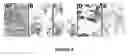 Fig. 07 - Galectins -1 and -4 in tumor development