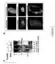 Fig. 03 - Substituted pyridinyl and pyrimidinyl derivatives as modulators of metabolism and the treatment of disorders related thereto