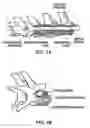 Fig. 02 - Systems and methods for controlling and forming polymer gels