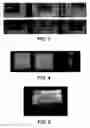 Fig. 04 - Systems and methods for controlling and forming polymer gels