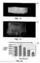 Fig. 12 - Systems and methods for controlling and forming polymer gels