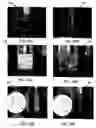 Fig. 17 - Systems and methods for controlling and forming polymer gels