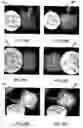 Fig. 18 - Systems and methods for controlling and forming polymer gels
