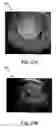 Fig. 20 - Systems and methods for controlling and forming polymer gels