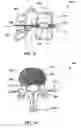 Fig. 30 - Systems and methods for controlling and forming polymer gels