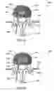 Fig. 31 - Systems and methods for controlling and forming polymer gels