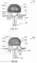 Fig. 32 - Systems and methods for controlling and forming polymer gels