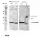 Fig. 17 - Use of soluble forms of CD83 and nucleic acids encoding them for the treatment or prevention of diseases