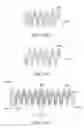 Fig. 10 - Helical brachytherapy apparatus and methods of using same