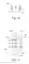 Fig. 20 - Helical brachytherapy apparatus and methods of using same