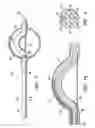 Fig. 03 - Asymmetrical irradiation of a body cavity