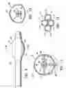 Fig. 04 - Asymmetrical irradiation of a body cavity