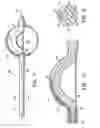 Fig. 03 - Methods for asymmetrical irradiation of a body cavity