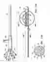 Fig. 06 - Methods for asymmetrical irradiation of a body cavity