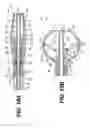 Fig. 08 - Expandable brachytherapy device