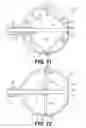 Fig. 09 - Expandable brachytherapy device