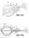 Fig. 14 - Expandable brachytherapy device