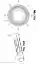 Fig. 16 - Expandable brachytherapy device