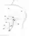 Fig. 01 - Ferromagnetic injection aneurysm repair
