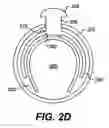 Fig. 07 - Endoscopic apparatus and method