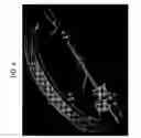 Fig. 05 - Method and apparatus for alignment of a mobile fluoroscopic imaging system