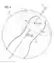 Fig. 05 - Reconstruction method for images of the beating heart