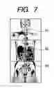 Fig. 07 - Magnetic resonance imaging apparatus and imaging method in the same