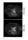Fig. 22 - Method of MR imaging