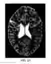 Fig. 23 - Method of MR imaging