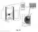 Fig. 11 - Tissue interventions using nuclear-emission image guidance